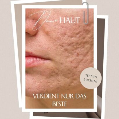 Pure Skin by Jean-Pascal in Rheine