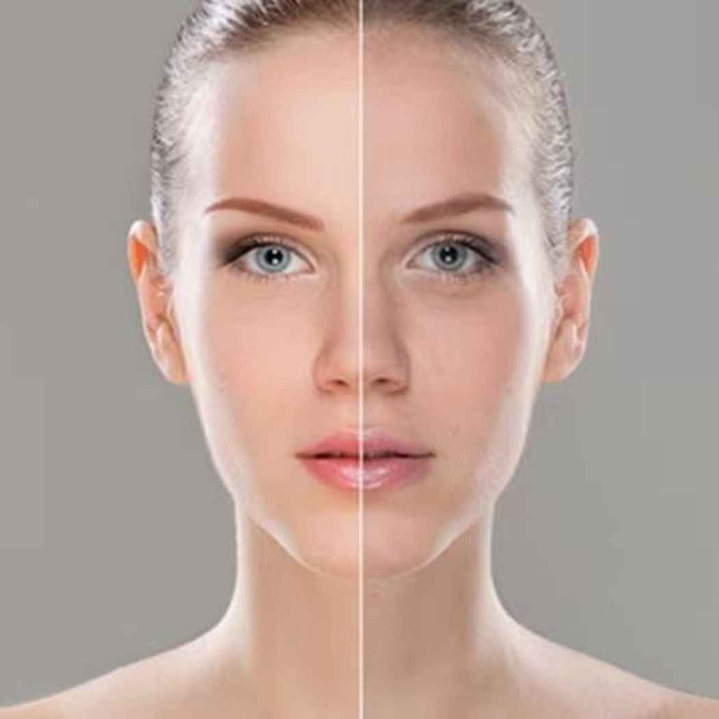 Pre & Anti Aging in Rheine - Pure Skin by Jean-Pascal Rheine