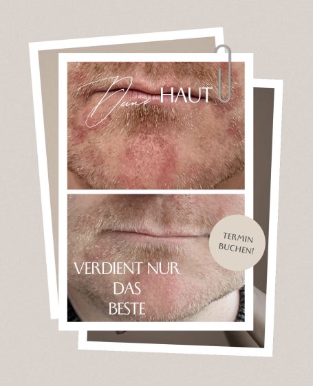 Nahaufnahme eines männlichen Gesichts mit Fokus auf den Mund und einem Slogan.